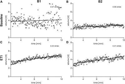 Differential effects of ELX/TEZ/IVA on organ-specific CFTR function in two patients with the rare CFTR splice mutations c.273+1G>A and c.165-2A>G